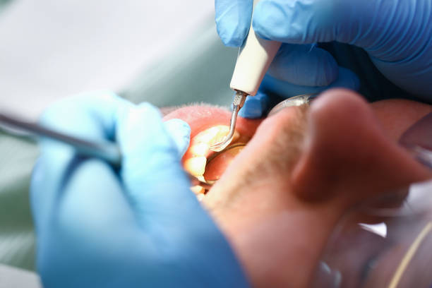 Best Emergency Cosmetic Dentistry (e.g., broken veneers) in Basking Ridge, NJ