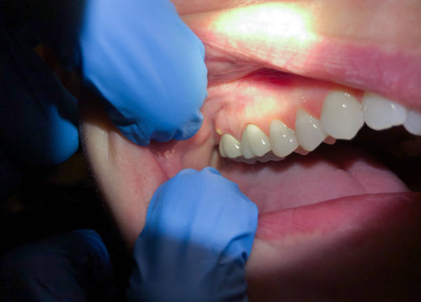 Best Emergency Treatment for Jaw Pain or Injury in Basking Ridge, NJ